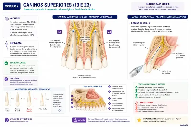 Caninos superiores 13 e 23 — anatomia, inervação e técnica