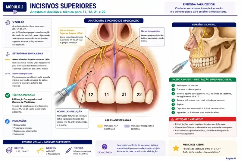 Incisivos superiores — anestesia, decisão e técnica
